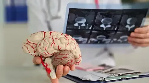 What is the Best Treatment for Stroke?